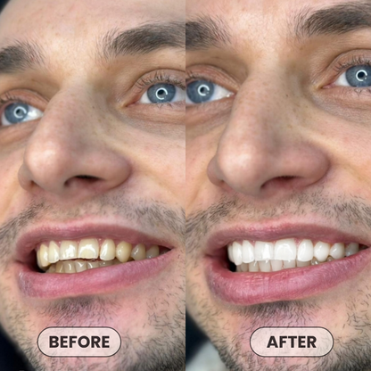 Aura & Co Deep Clean Whitening Mouthwash | Fresh Breath & Stain Removal