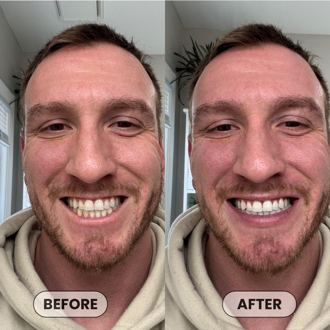 Aura & Co Deep Clean Whitening Mouthwash | Fresh Breath & Stain Removal