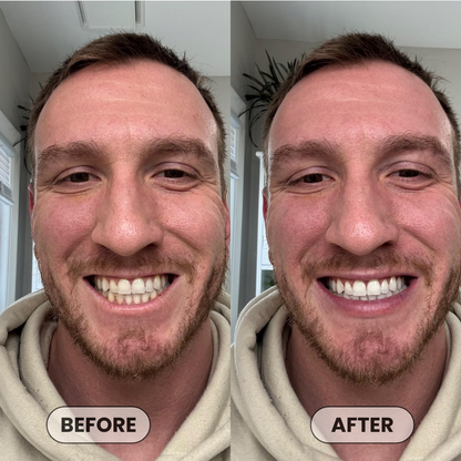 Aura & Co Deep Clean Whitening Mouthwash | Fresh Breath & Stain Removal