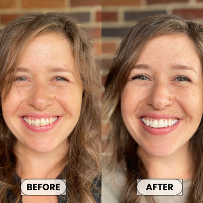 Aura & Co Deep Clean Whitening Mouthwash | Fresh Breath & Stain Removal